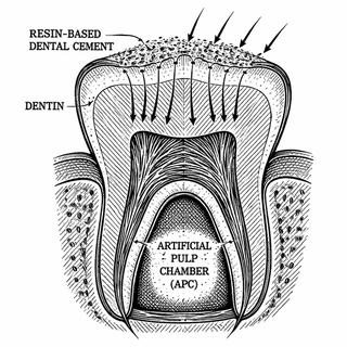 The Dental Cement Showdown: Which Resin-Based Cements Are Actually Safe for Your Pulp Cells?