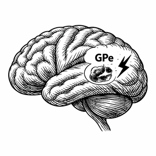 The Brain's Secret Sleep Switch: Why Zapping a Tiny Region Might Finally Help Parkinson's Patients Sleep